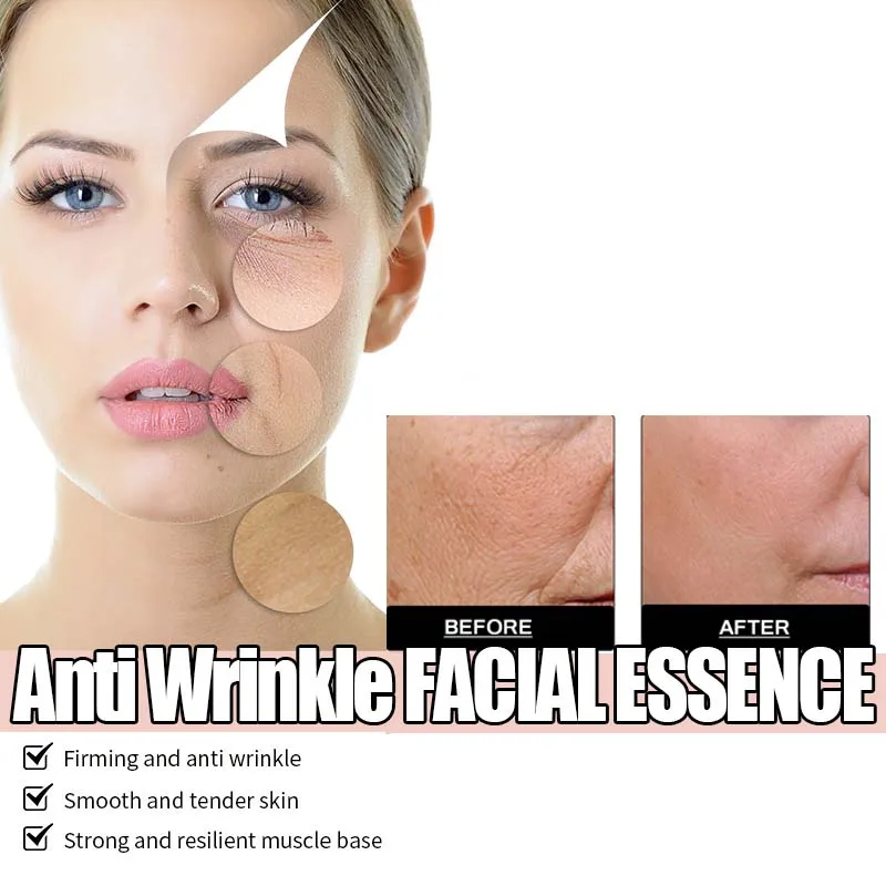 

Коллагеновая эссенция для лица против морщин, увлажняющая и восстанавливающая кожу барьерная защита, восстановление кожи, продукты ухода за кожей