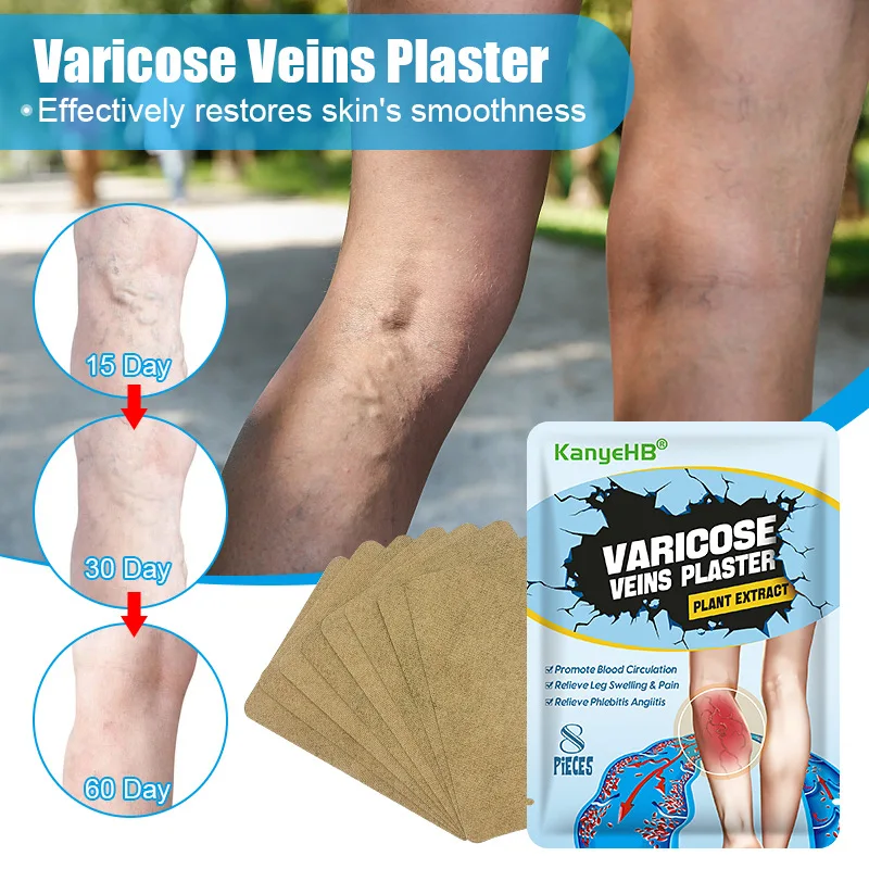 8PCS/Bag Effective Varicose Veins Treatment Patch Legs Sore Swelling Plaster Promote Metabolism Promote Smooth Blood Circulation