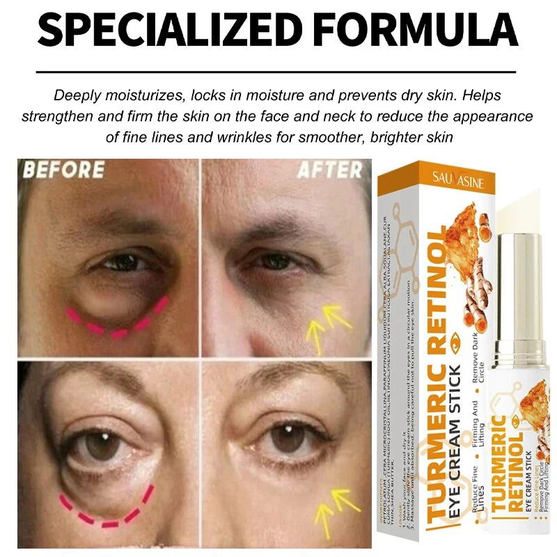 Instant Eye Bag Remove Eye Cream Anti Fat Particles Dark Circles Puffiness Fade Fine Lines Lift Brighten Korean Beauty Eye Care