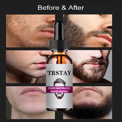 Óleo essencial natural do crescimento eficaz da barba para homens, líquido, perda de cabelo, produtos do tratamento, realçador, nutriente, crescimento home da barba