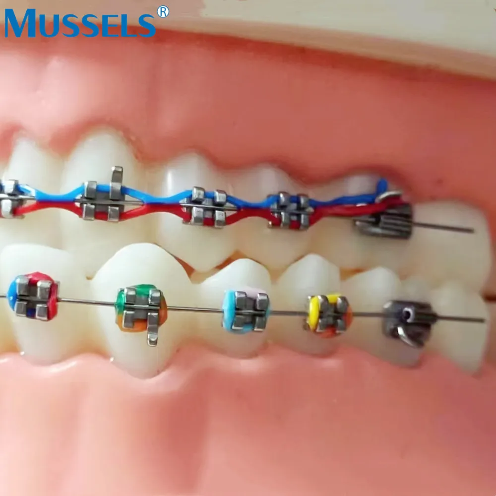 Ligaduras elásticas de ortodoncia Dental, 21 colores, cadena eléctrica para tirantes, bandas de goma, soportes de odontología, continuo, largo y