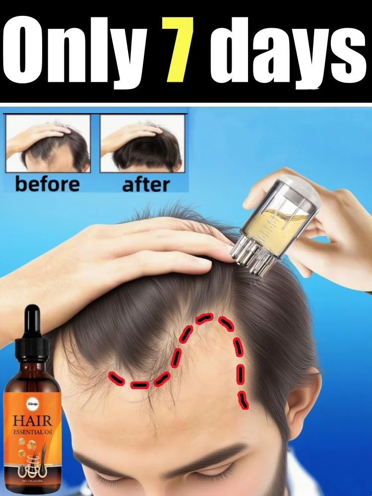 

Инструменты для ухода за кожей головы 2025 года для создания более толстых волос, кажутся на прощай на волосы, сейчас самых продаваться!