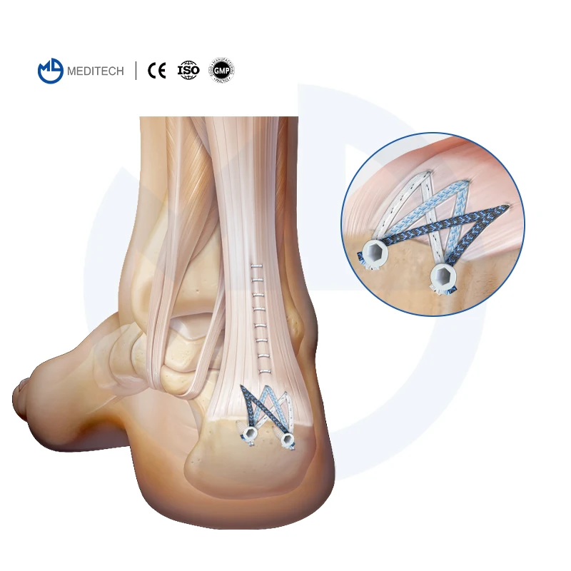 Czmeditech Full Sut…