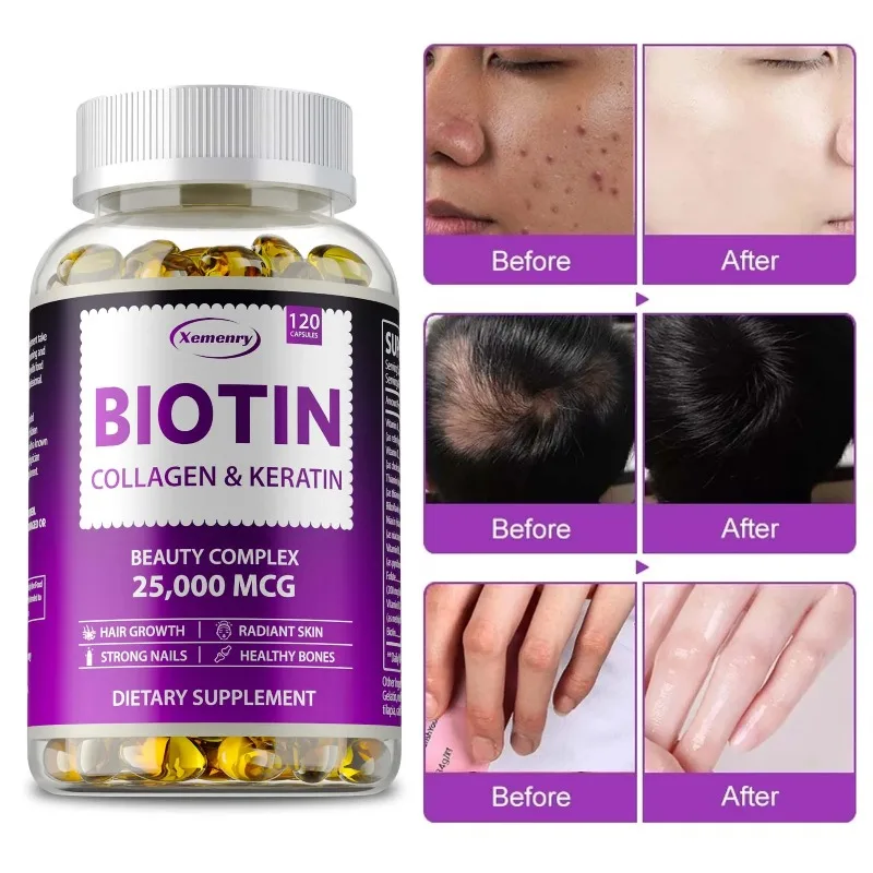 

Biotin Collagen and Keratin Supplement - Support Healthy Skin, Joint, Hair, Nail -Antioxidant Dietary Supplement