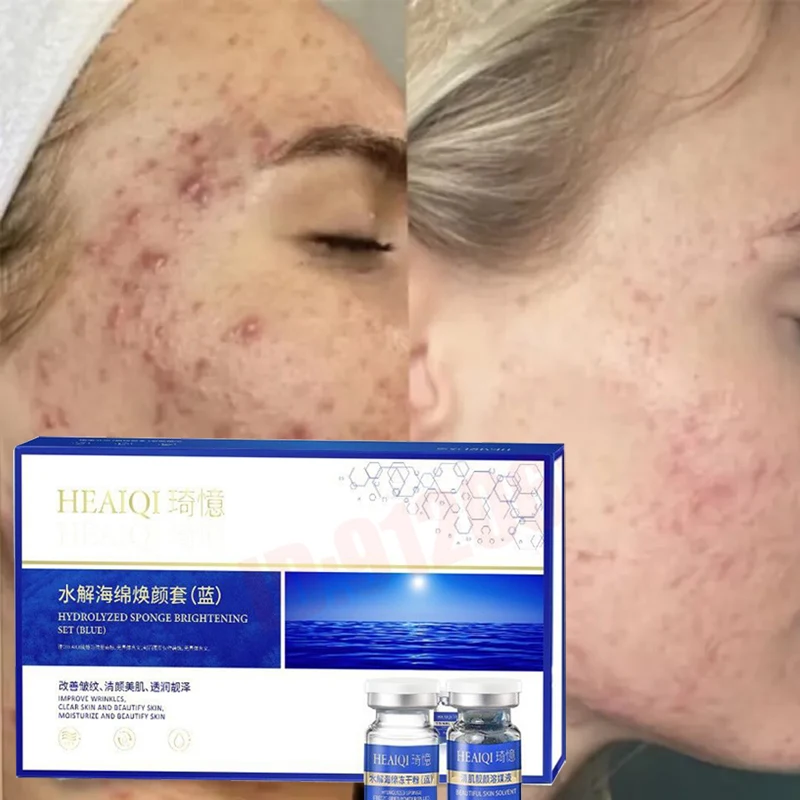 

10 шт., медный пептид, пилинг водорослей, отбеливающий набор для кожуры мелазмы, натуральный экстракт кости морских водорослей, растительный экстракт, маска, омоложение, увлажнение