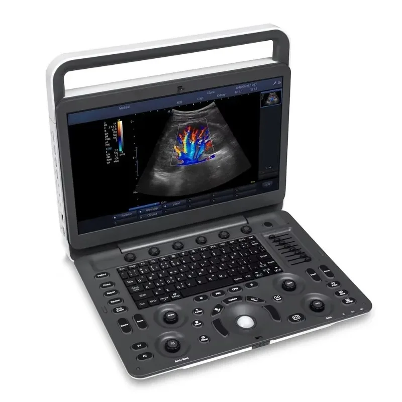 High Quality Ultrasound E2V Large Animal Portable Vet Ultrasound Machine for Pregnancy Test in Animals