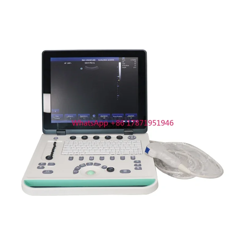 

SY-A032-2 factory price pregnancy- ultrasonic scanner easy to carry Ultrasound machine for pet hospital