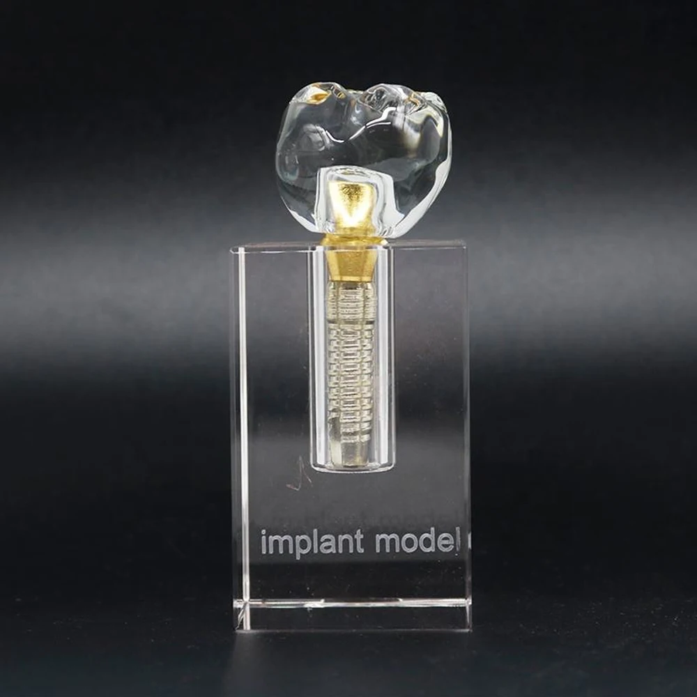 

1PC Dental Lab Clinic Decoration Dental Demonstration Molar Teeth Implant Crystal Model