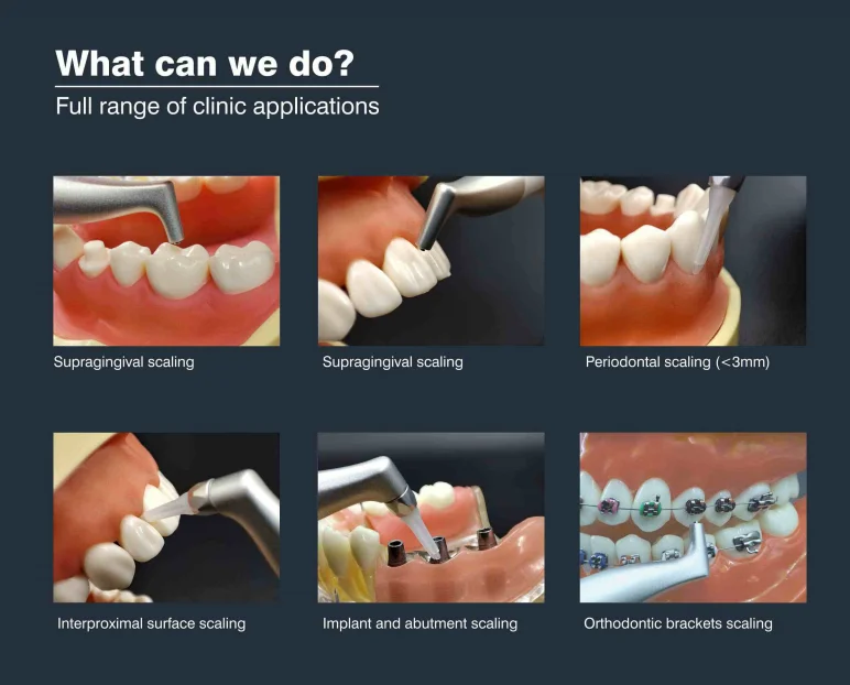 Airjet 2 Dental Teeth Polishing Sandblasting  Electric Turbine Cleaning Filling Made Steel Plastic Metal