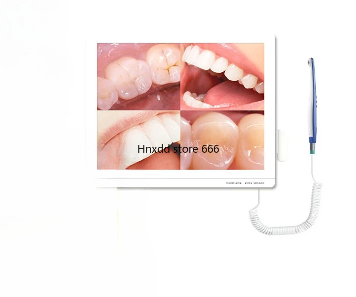 Oral observer high definition camera to take pictures to check teeth