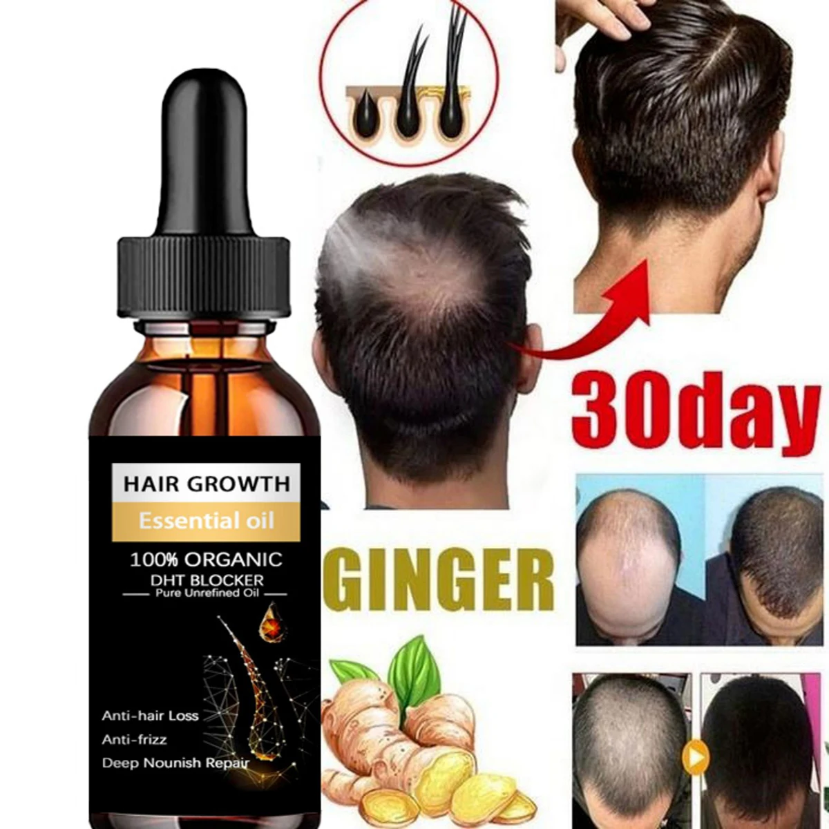 Hair Spray GROWER Product  Anti-hair Loss Essential Oil -Growth Serum Hair Growth for Men