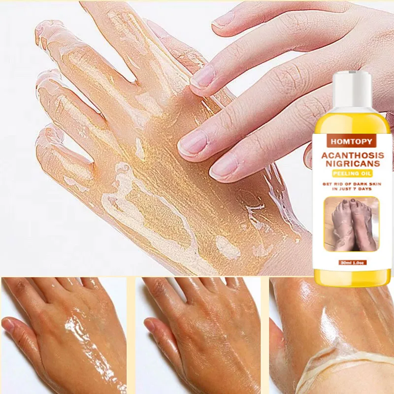 

Body Care Exfoliating Yellow Peeling Oil 100% Organic Bleaching Dark Skin Serum Dark Knuckles Fast Whitening Cosmetics