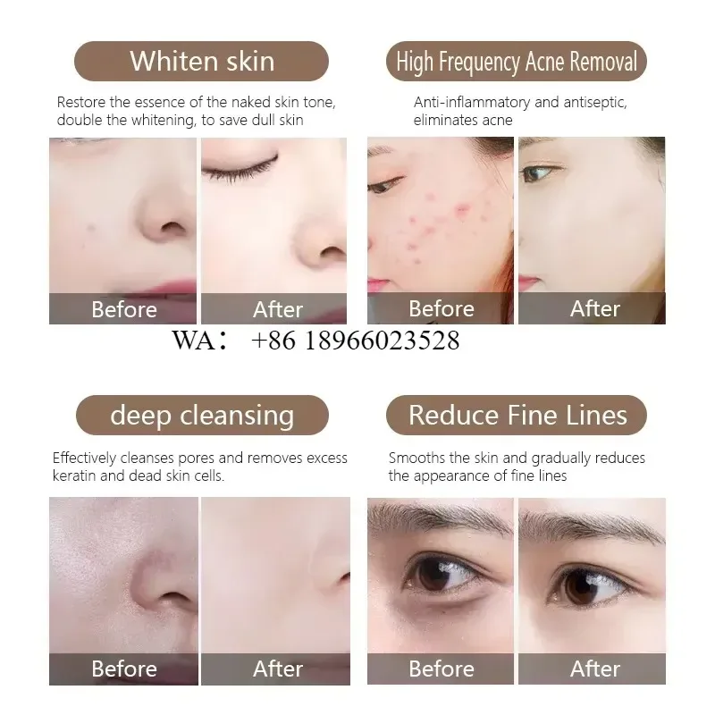 WMWMNU 9 in 1 Newest Facial Care Equipment Peel Firming Dermabrasion Oxygen Jet for Hydra Bubble Beauty