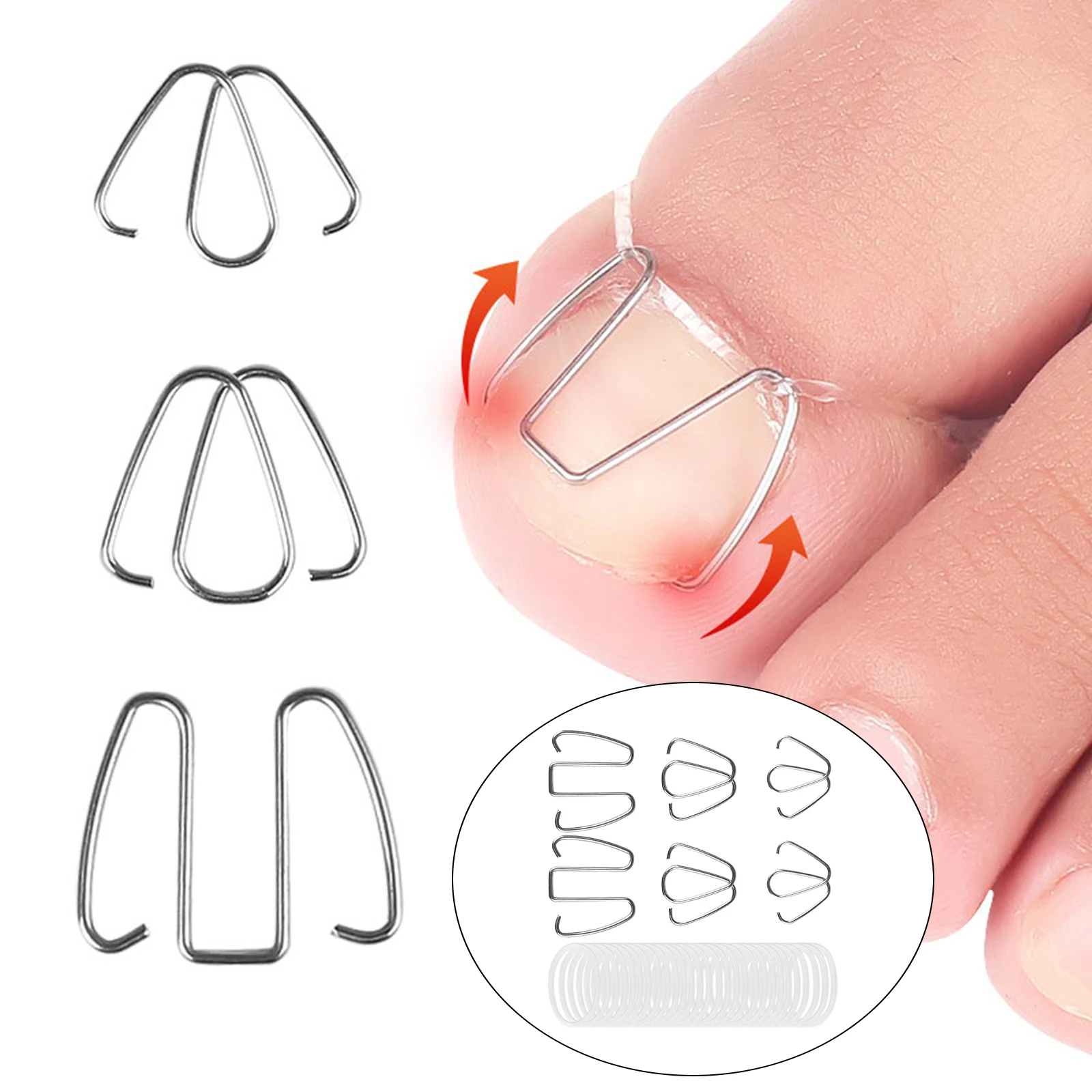 6x Ingrown Toe Nail Corrector Strips Wire Bunion Toenail Fixer Foot Care Recovery Nail Correction Hook For Relieve Discomfort