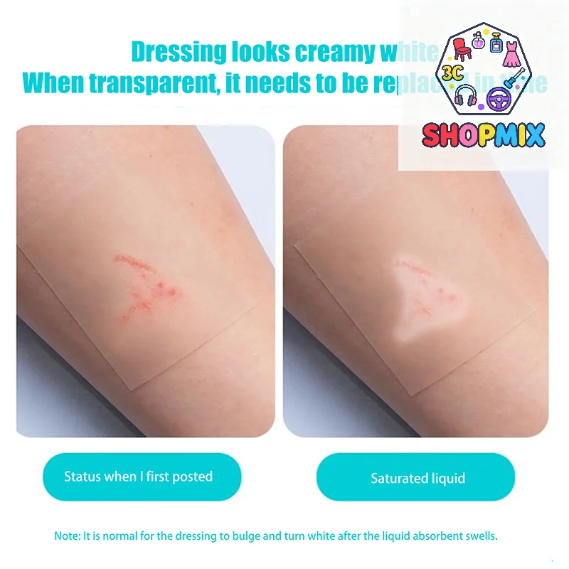 

Hydrocolloid Roll For Wound Care Hydrocolloid Patch Bandages With Self-Adhesive, Bed Sore Bandages, Highly Absorbent For Burn