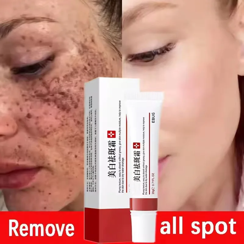 

Niacinamide Whitening Freckle Cream Remove Dark Spots Anti Aging Cream Fade Pigmentation Melasma Brighten Serum SkinCare Product