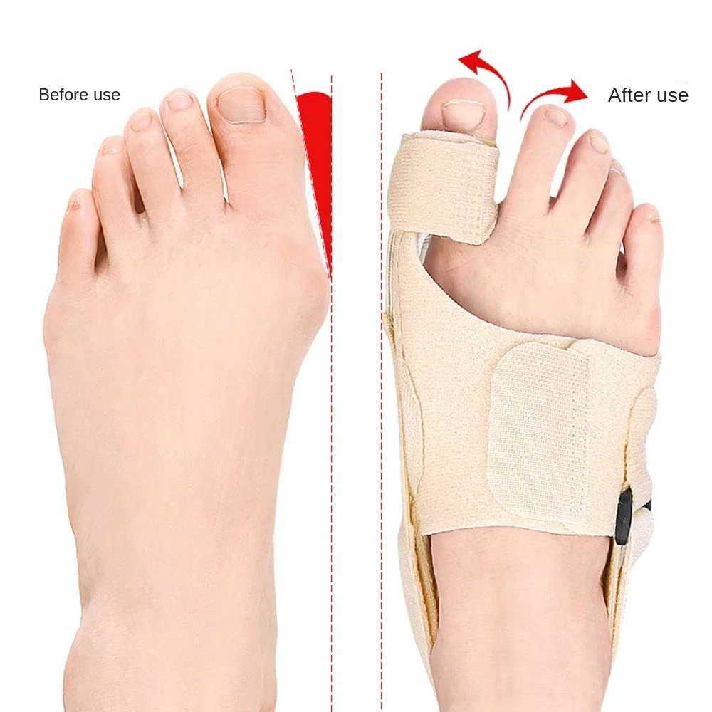 

Feet Valgus Corrector Toe Orthotics Brace Bunion Protector Thumb Valgus Adjuster Toe Straighteners Nude Color Foot Care Tools