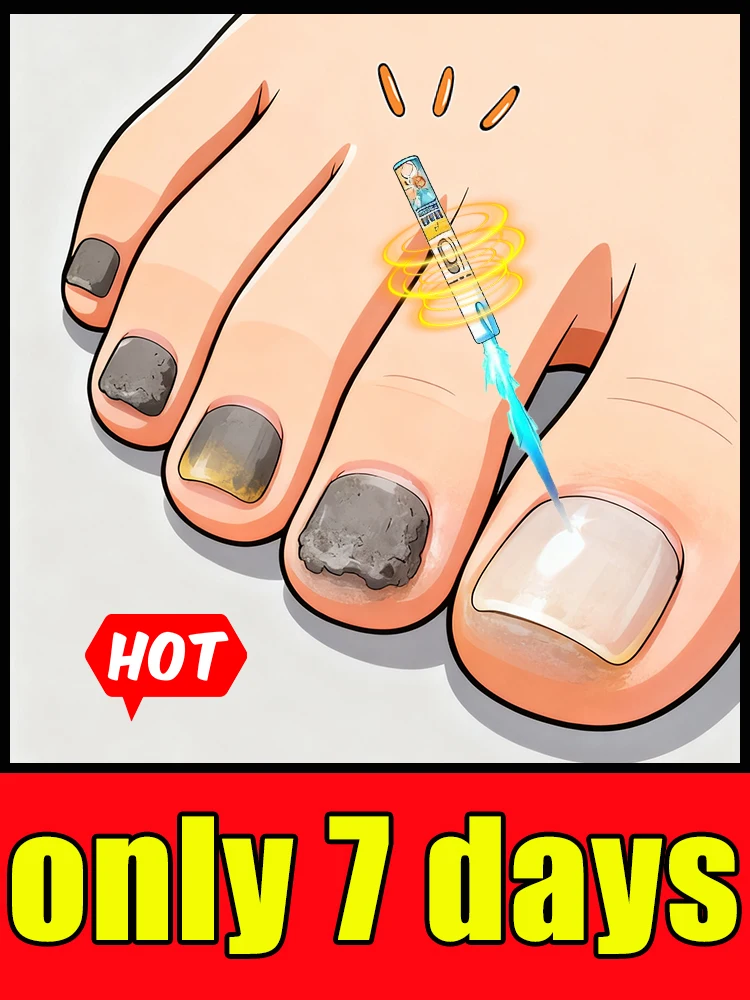 

Say goodbye to nail fungus troubles through blue light antibacterial technology.