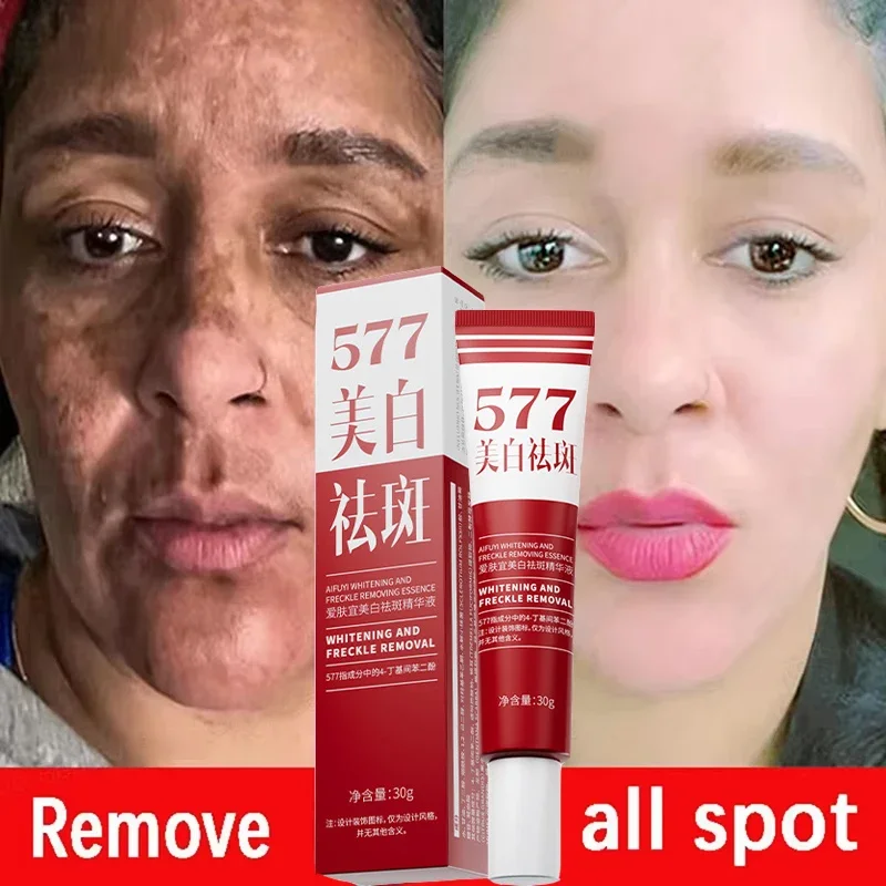 

Whitening Freckles Face Cream Removal Melasma Dark Spots Corrector Lighten Melanin Pigmentation Brighten Anti-Aging Beauty Care