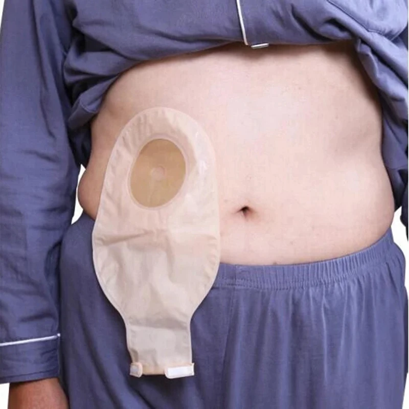 Ostomy Bags One Piece Drainable Pouches for Colostomy Ileostomy Stoma Care 20-60mm Economical Drain Valve Colostomy Bags