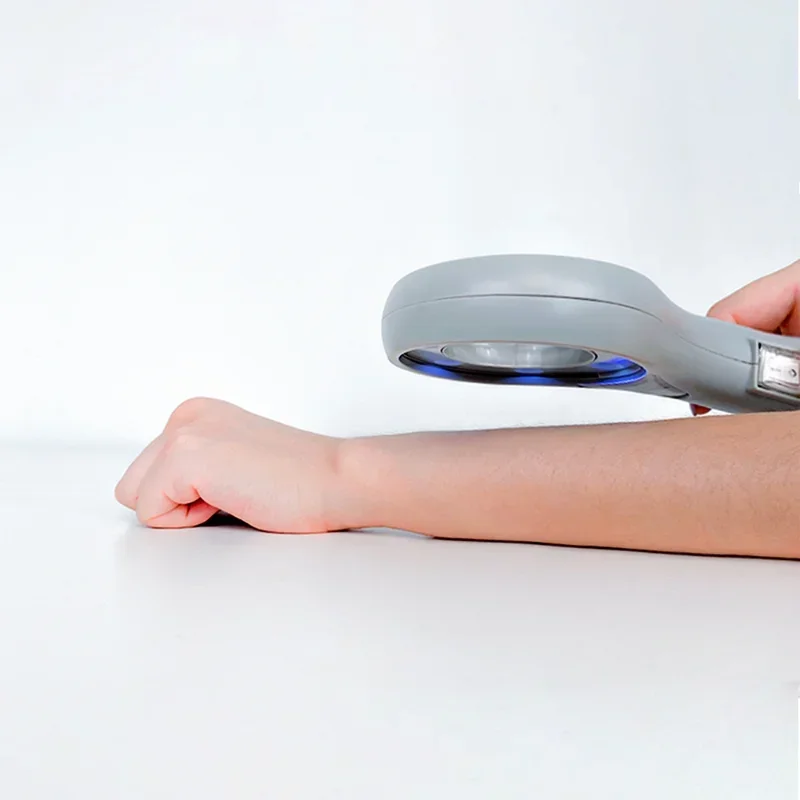 محلل الحيوانات UVA LED مصباح الخشب البيطري مصنع المعدات البيطرية الطبية المهنية #2