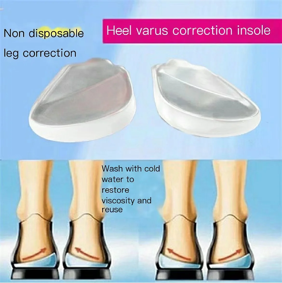 X/ O-shaped Leg Correction Insole Inside Eight Figure Outside Eight Straighten Healthy Beautiful Legs Correct Looped Legs