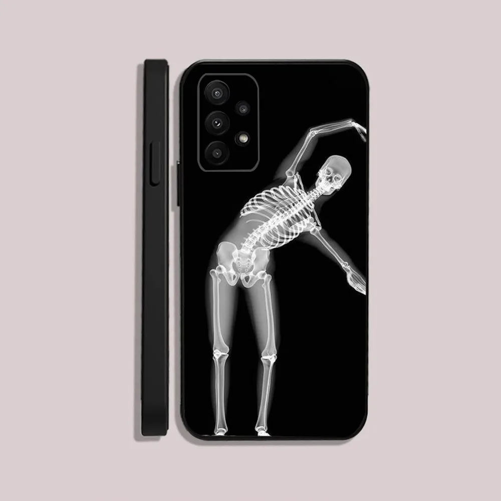 Radiological Human Skeleton Phone Case For Samsung S24,23,22,30,21,10,9,Ultra,Plus,Lite,FE,5G Black Soft Case