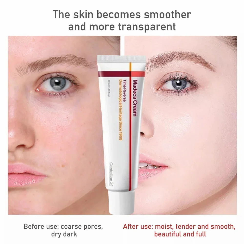 New Centellian24 PDRN Madeca Cream Lightweight Hydrating Moisturizer Promotes Skin Regeneration Redness Relief All Skin Types