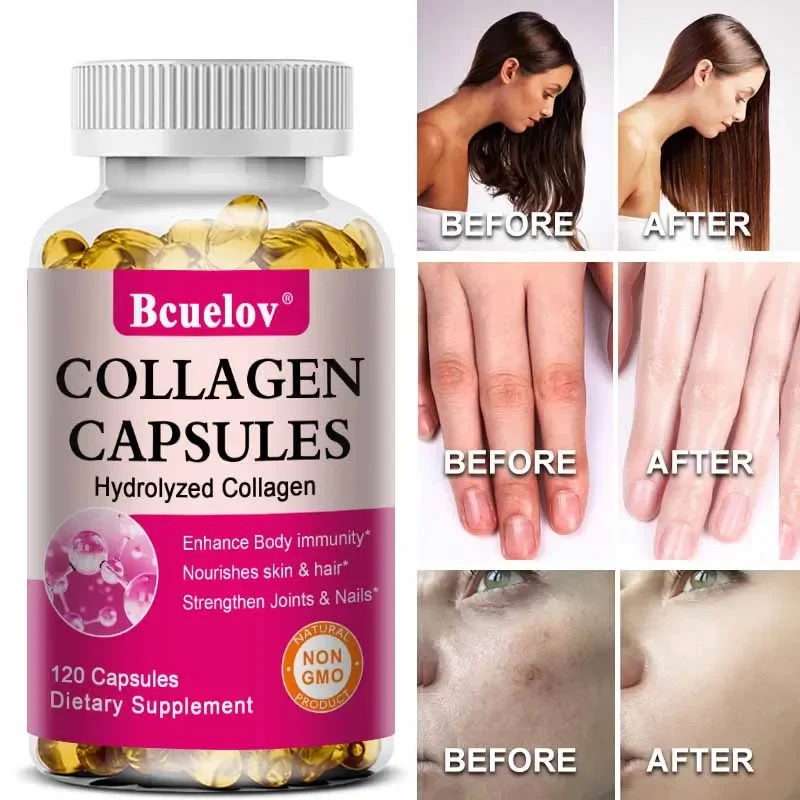 Collagen Capsules - Hydrolyzed Collagen Supplement - Promotes Healthy Skin, Nails and Hair, Strengthens Joints, Vitamin C Biotin