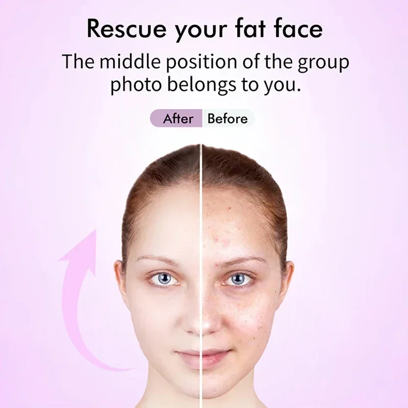 EMS 5 في 1 مدلك الوجه 4D تدليك رئيس الخامس خط شد الوجه العلاج بالضوء مدلك مزيل التجاعيد شد الجلد العناية بالجمال