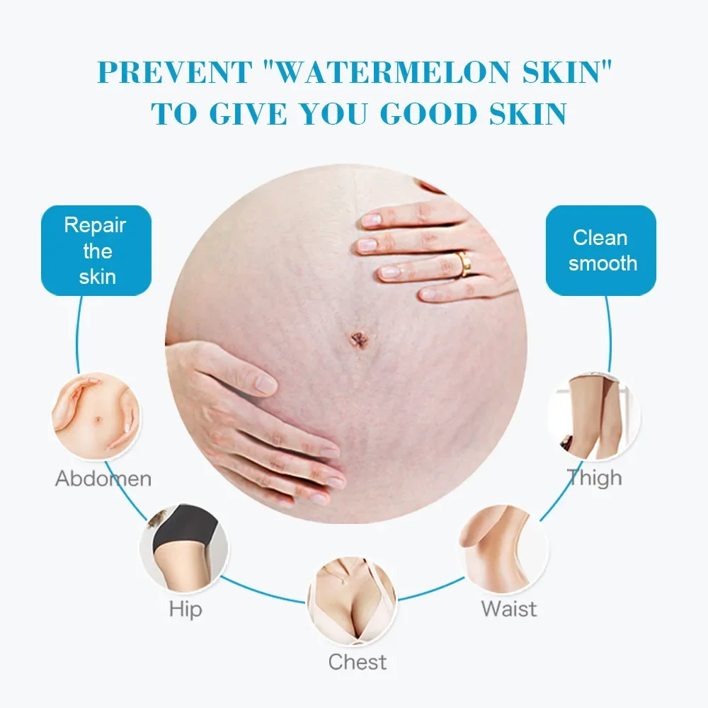 Snail Removes Stretch Mark Cream To Remove Postpartum Obesity Pregnant Women Repair Anti-Aging Anti-Winkles Firming Body Cream view 2