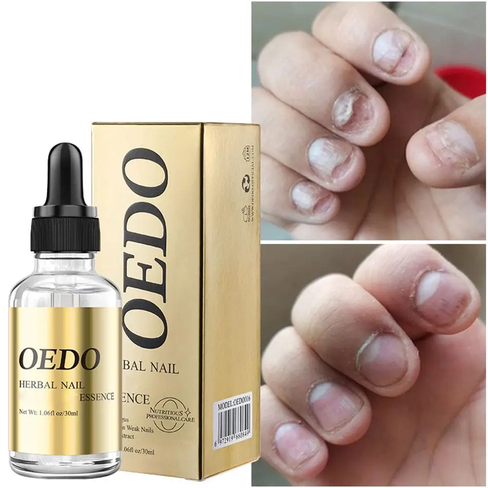 Sérum de traitement des ongles antifongique à base de plantes, solution transparente pour la réparation des ongles, tonifiant frais, apaisant, croissance, 30ml, Na M1X8