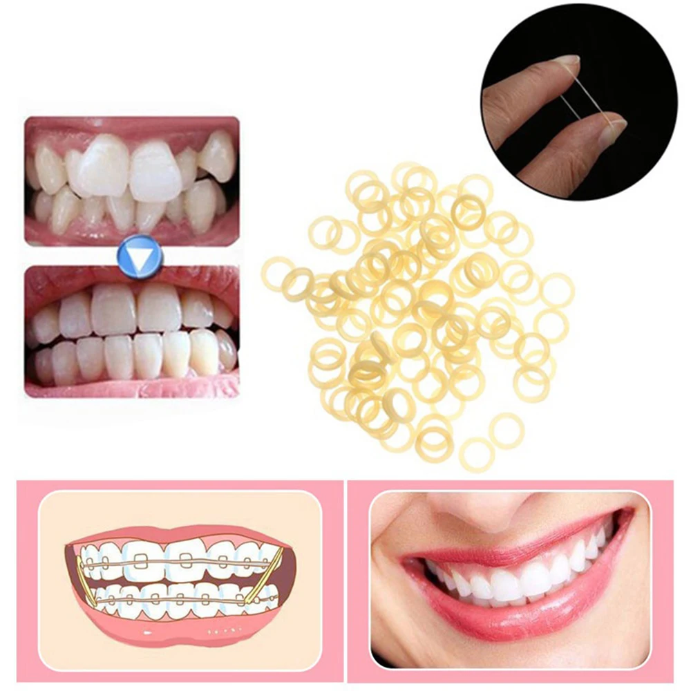 3.5 / 5.0 / 6.5 Oz Dental Elastics Rubber Bands  Orthodontic High-Quality Latex Braces Force Zoo Pack