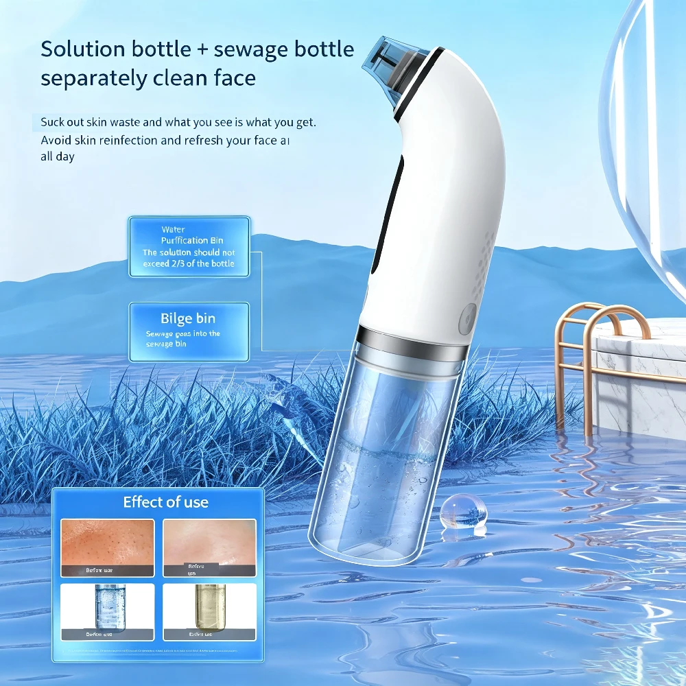 Siyah Nokta Çıkarıcı Gözenek V - Pore Vacuum incelemesi ve fiyatı