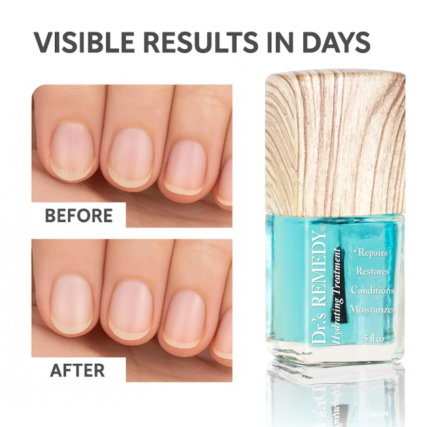 مجموعة معالجة تقوية الأظافر العضوية مكونة من 3 قطع مع زيت البشرة، وغير سامة وجميعها طبيعية للأظافر الصحية