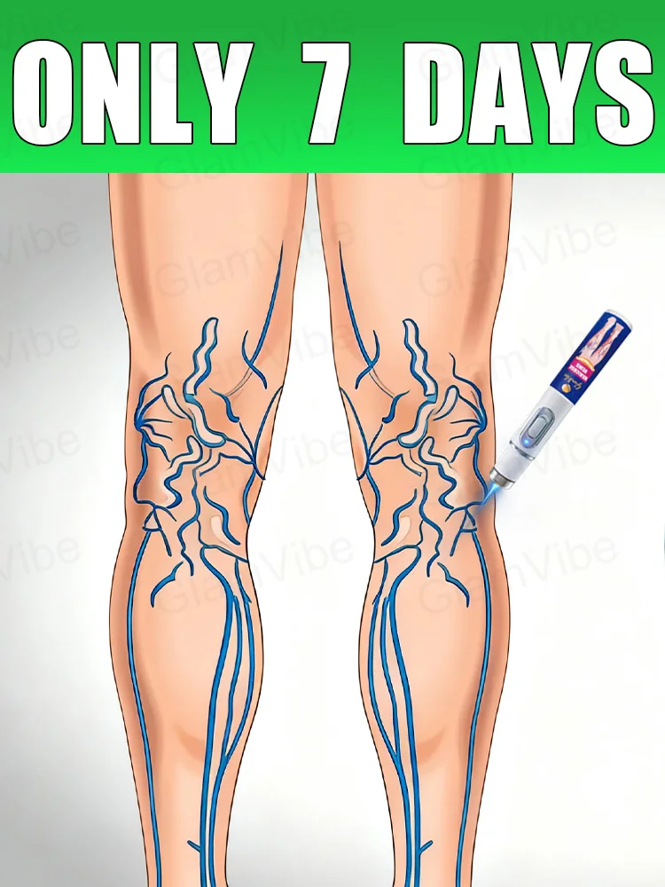 

blue light pen solve varicose veins, hot sale leg care tools