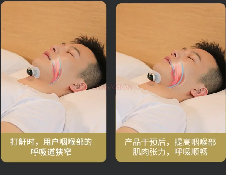 

Intelligent electric anti snoring and anti snoring ventilator portable sleep improvement snoring correction