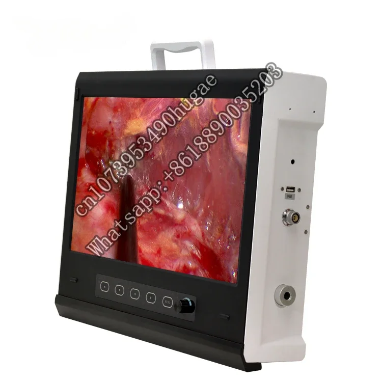 YKD-9119 Light Source Integrated HD Endoscopy  for Spine Surgery