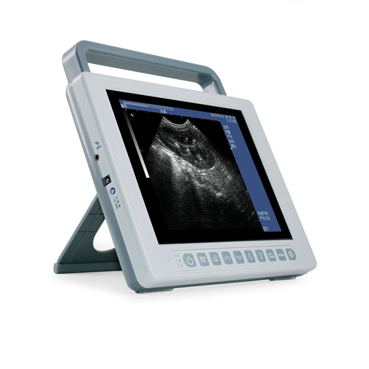 for Cheap Medical Portable Ultrasound Machine Full Digital B Mode ultrasound Scanner for sale