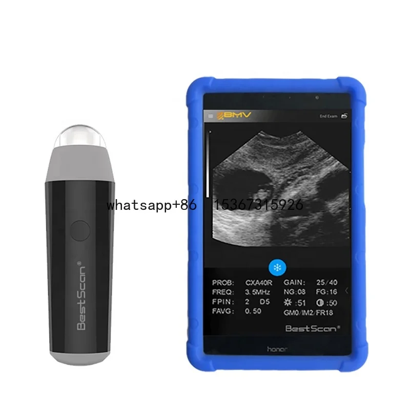 BestScan S3 wireless goat//Sheep/Pig/sow/porcine portable Veterinary Ultrasound Equipment/Machine/Scanner