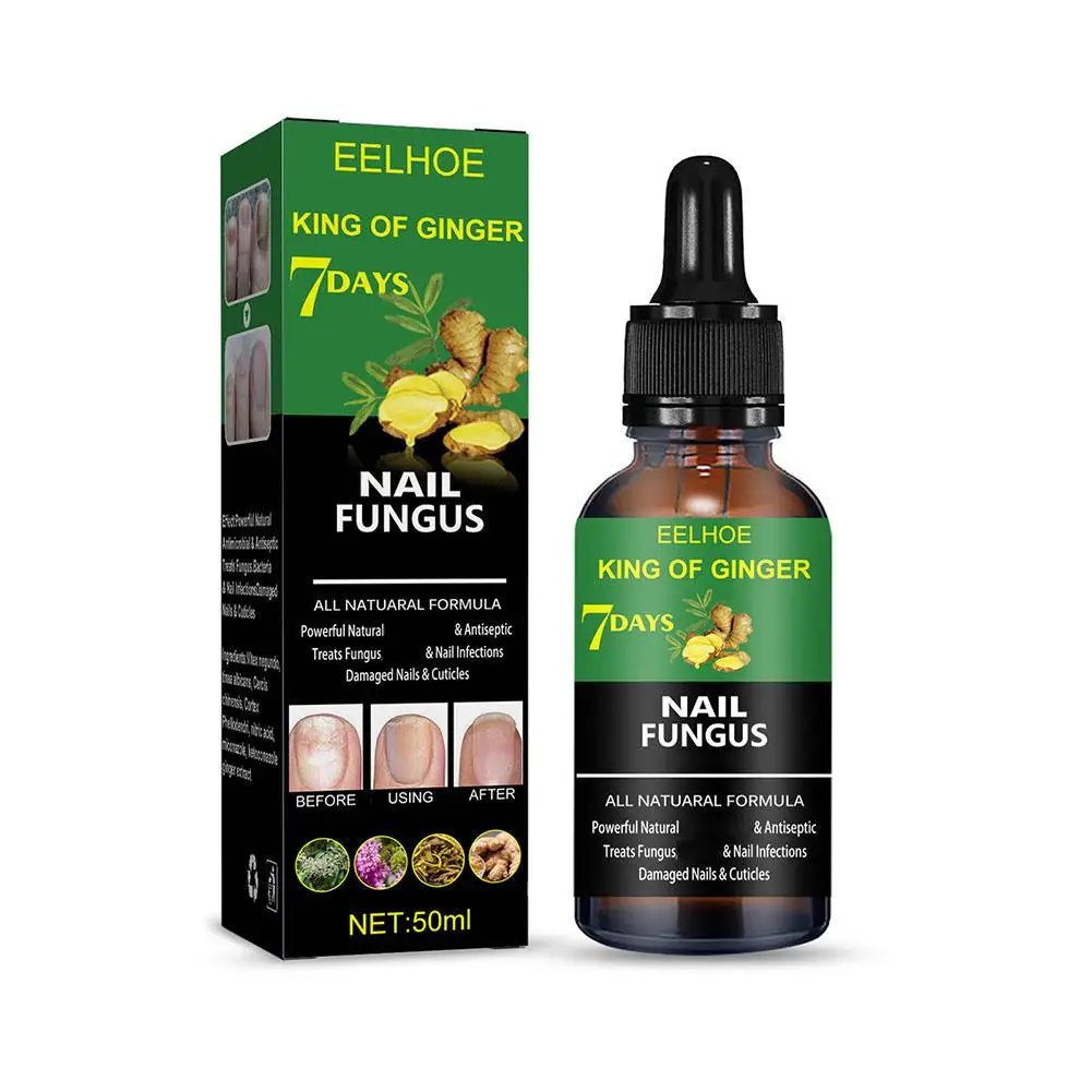 50ml Ginger Nail Fungal Treatments Feet Care Essencial Liquid Paronychia Anti Repair Onychomycosis Infections Toe Care Foot M7C3