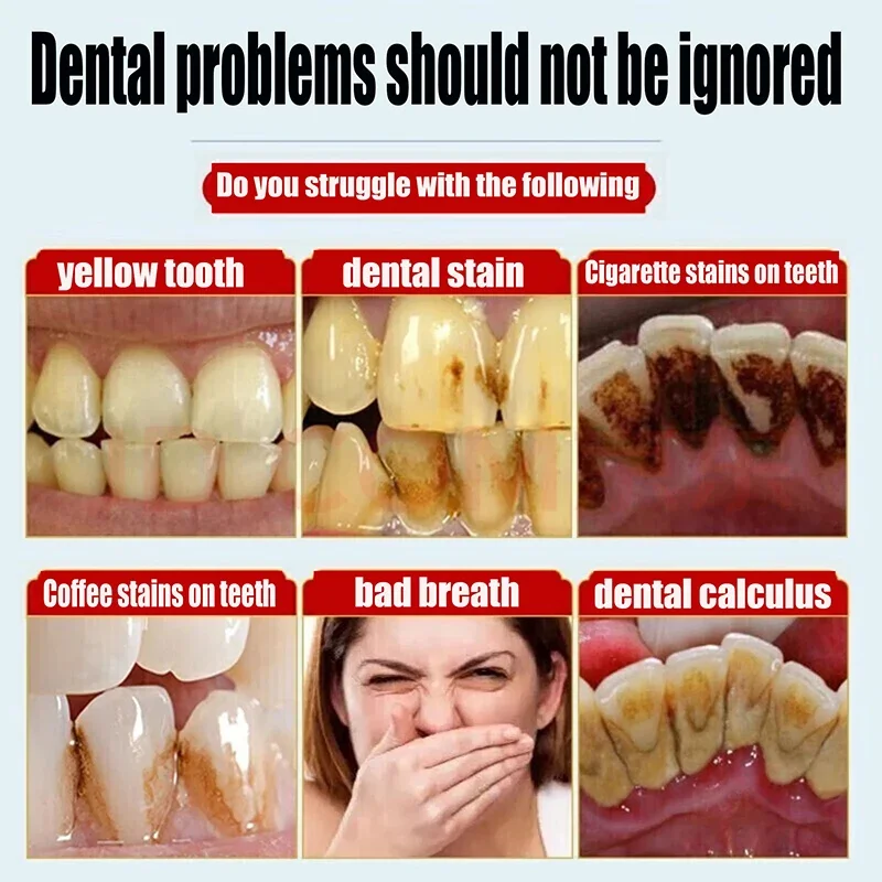 Pasta de dientes para eliminar el mal aliento, elimina el cálculo, previene la Periodontitis, limpia y cuida los dientes amarillos