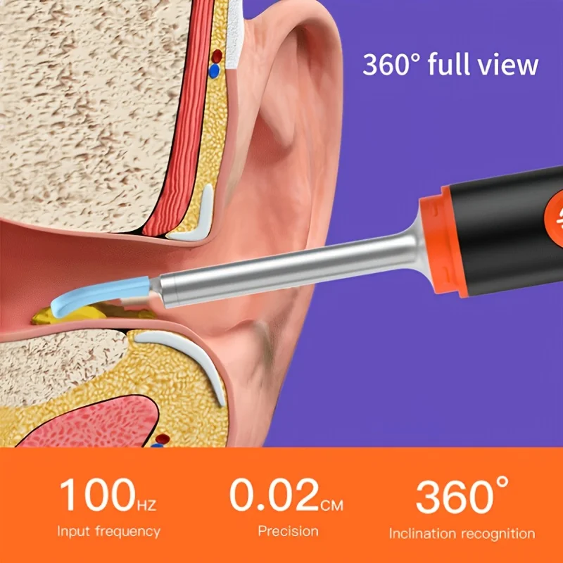 Entfernung von Ohrenschmalz, Ohrkamera, Kamera zum Entfernen von Ohrenschmalz mit 1080P, Otoskop mit Licht, Ohrenschmalz-Entfernungsset mit 6 Ohrstöpsel, E