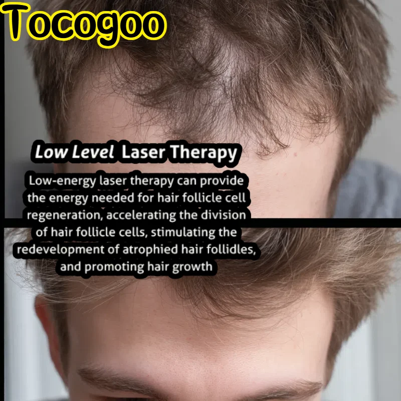 

Профессиональный набор для ухода за волосами 2025 года, терапевтический колпачок красного света 650 нм с массажером для кожи головы, полный раствор для роста волос