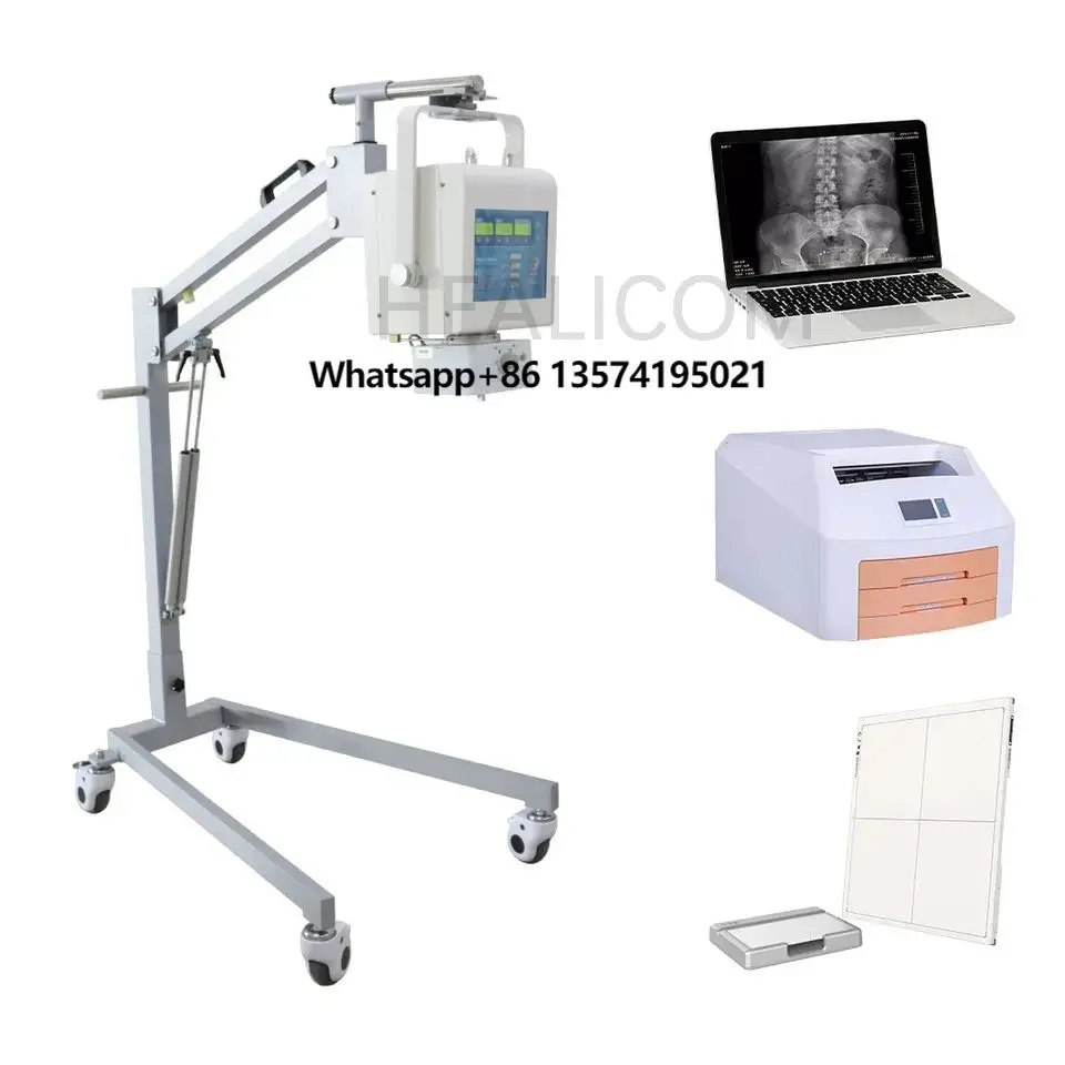 5KW Digital Portable Medical Xray Radiology Machine Mobile Digital X-ray Equipment Portable X Ray Machine