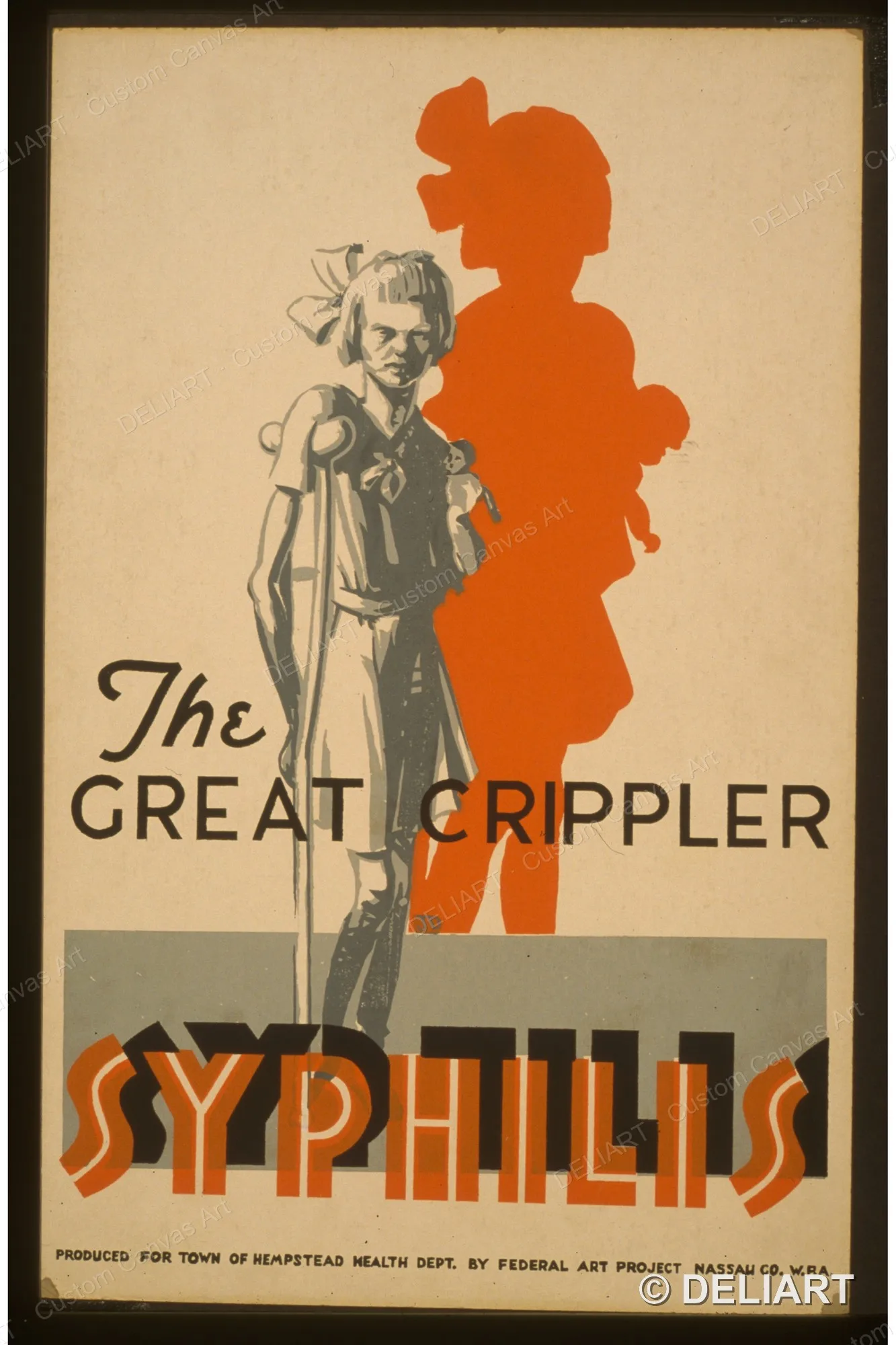 The great crippler - syphilis Vintage WPA Public Health Canvas Wall Art Poster Print Retro 1930s Nostalgic Home Decor Unframed