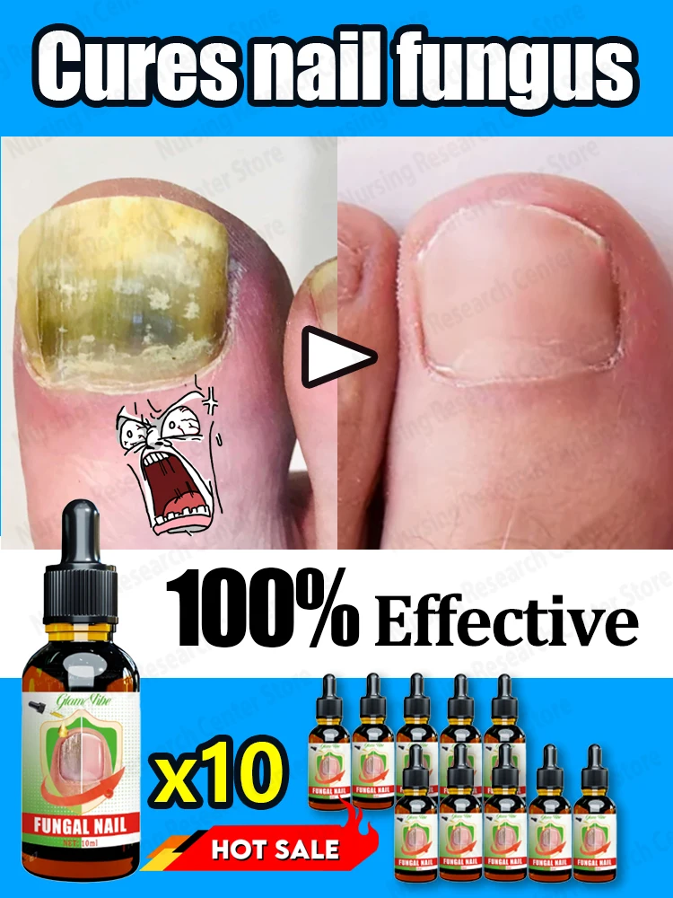 

Foot nail problems disappear