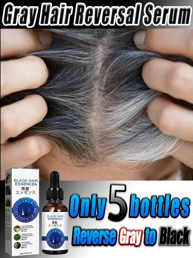 

Effective Gray Hair Serum Anti gray Reverse Gray Hair to Original Color White Hair Treatment Nourish Scalp oil