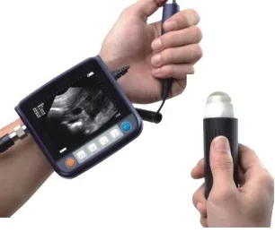 ce approved wrist veterinary ultrasound scanner