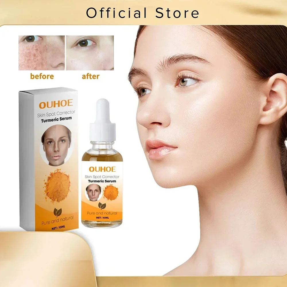 Freckle Whitening Turmeric Serum Melanin Correcting Lighten Acne Dark Patches Fade Pigment Brighten Dark Spots Corrector Serum